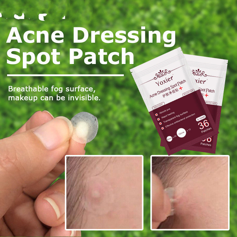 Skin Care Tools Acne Dressing Spot Patch Blemish Treatment Invisible Acne Stickers Pimple Remover Set Face Cream Skin Care Tools Acne Dressing Spot Patch Blemish Treatment Invisible Acne Stickers Pimple Remover Set Face Cream